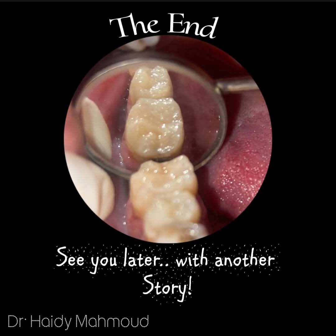 Tooth Tales